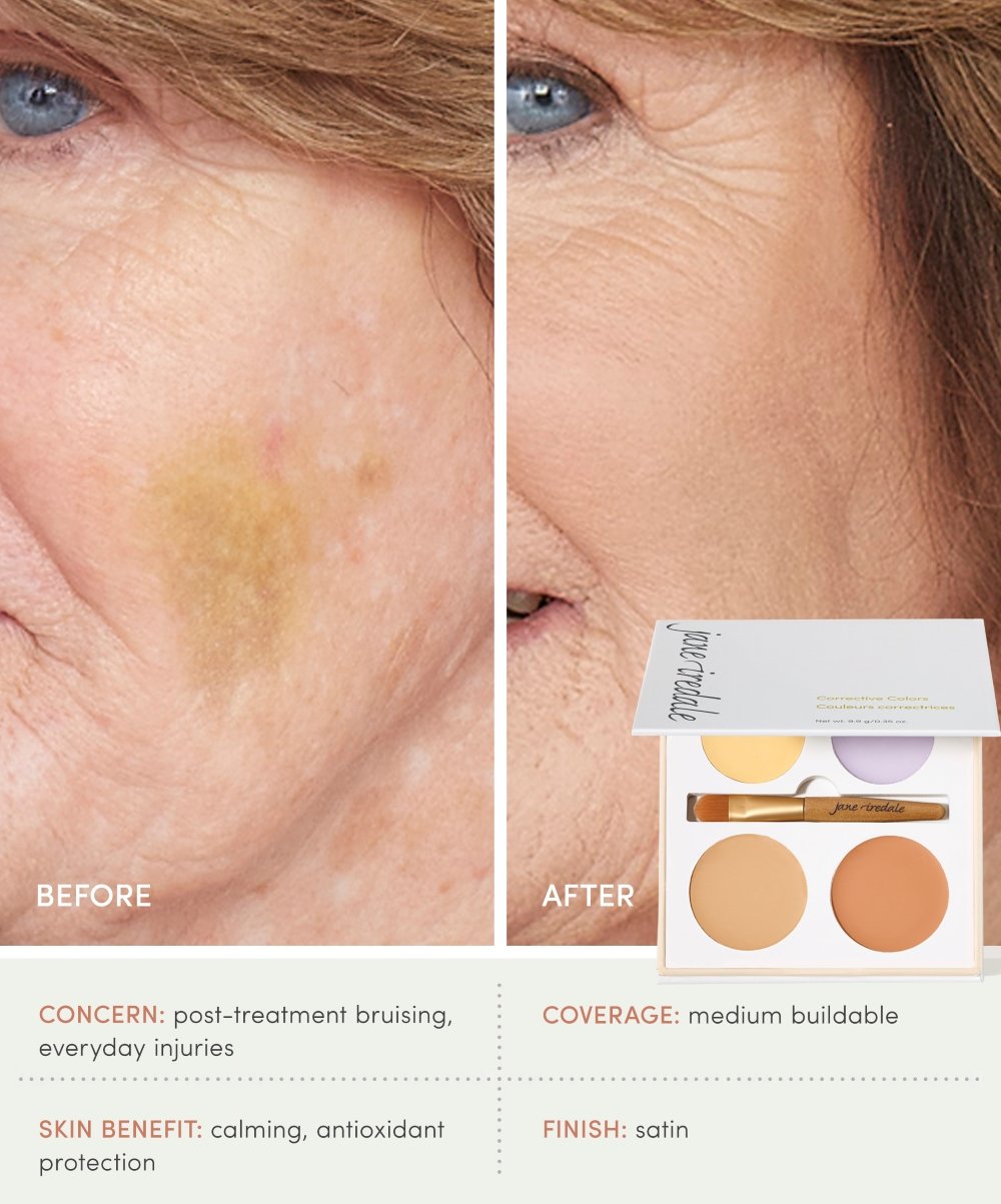 Concealer_Infographic_CorrectiveColors (2).jpg